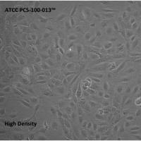 人正常原代脐静脉内皮细胞，混合来源（HUVEC）