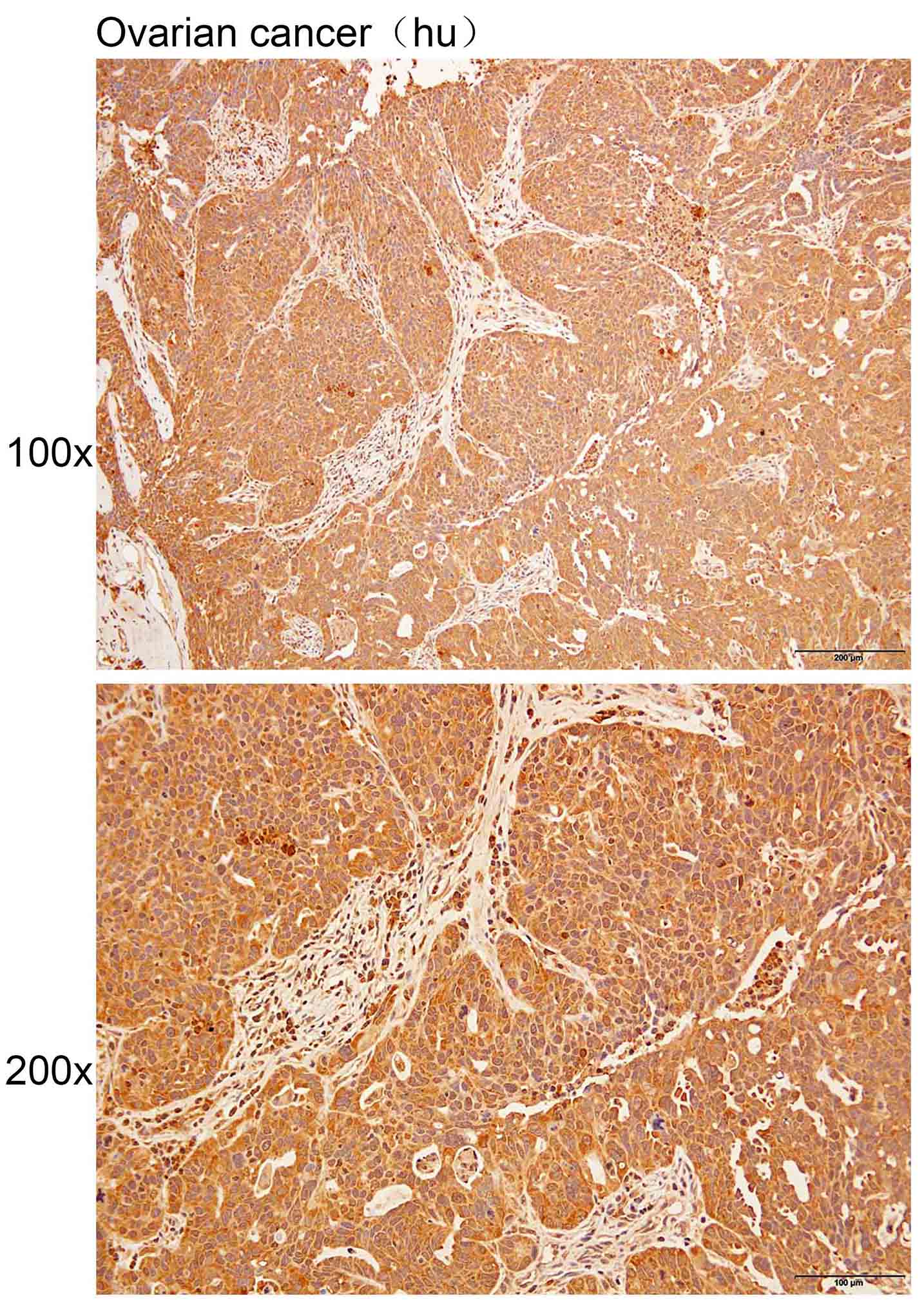 Anti-COL25A1 Polyclonal Antibo