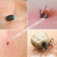 东方立克次体IgG/IgM抗体快速检测试剂盒