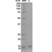 Gamma Synuclein 蛋白单体