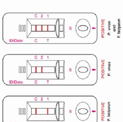 4种疟疾抗原快速检测卡使用说明书