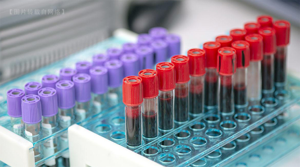 全自动血液分装处理工作站1