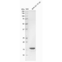 重组人Alpha Synuclein 蛋白单体(1 型)