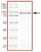 AKT激酶研究进展