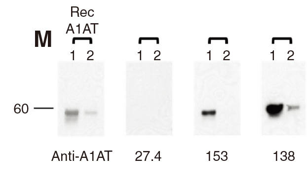 靶向治疗的“多面手”：丝氨酸蛋白酶抑制剂Serpins