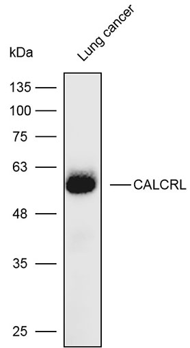 Anti-COL7A1 Polyclonal Antibod