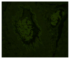 揭秘：防止组织自发荧光“轻骑兵”——Vector True VIEW™ Kit快速获得高质量图片