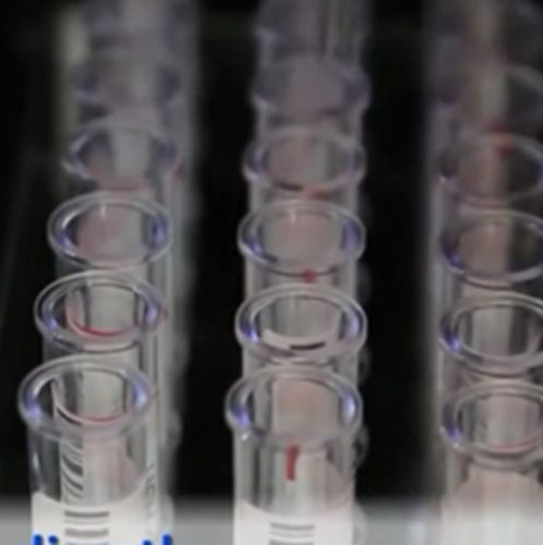 RRV罗斯河病毒IgM抗体ELISA诊断试剂(进口试剂)