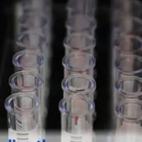 RRV罗斯河病毒IgM抗体ELISA诊断试剂(进口试剂)