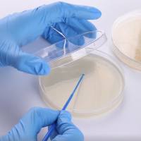 检测实验丨抑菌实验