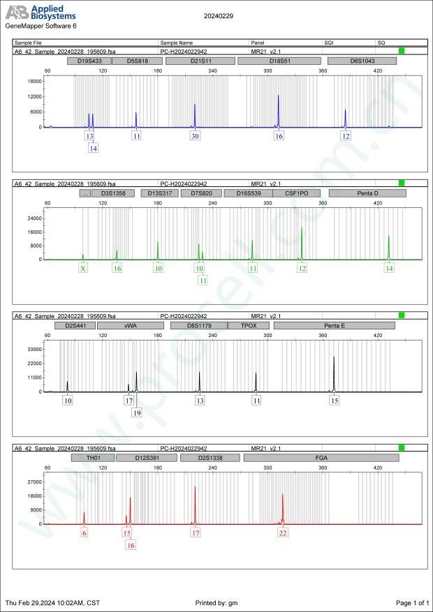 sNF96.2 (人雪旺细胞 (神经纤维瘤病Ⅰ型)) (ST