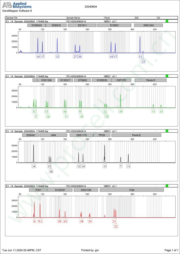 C8166(人T淋巴细胞白血病细胞) (STR鉴定正确)