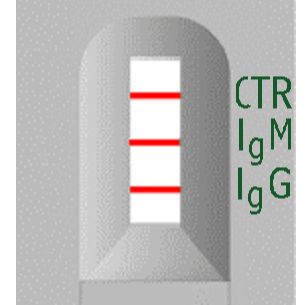 海关出入境 黄热病IgG/IgM抗体检测试剂盒