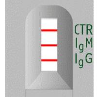 海关出入境 黄热病IgG/IgM抗体检测试剂盒