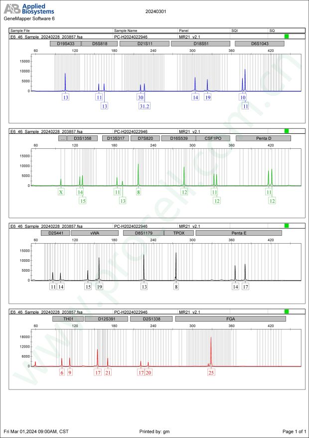 SU-DHL-8 (人B细胞淋巴瘤细胞) (STR鉴定正确)