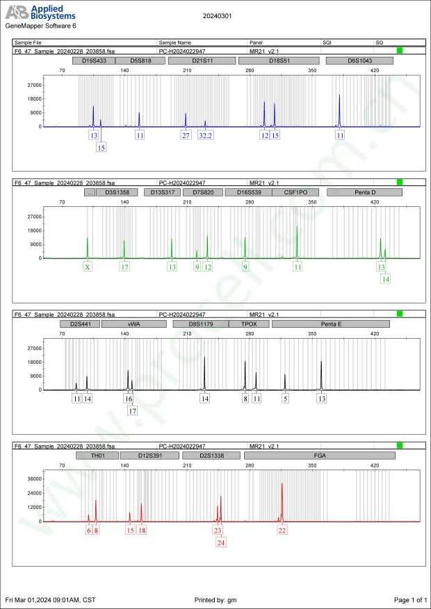 NCI-H526 (人小细胞肺癌细胞) (STR鉴定正确)