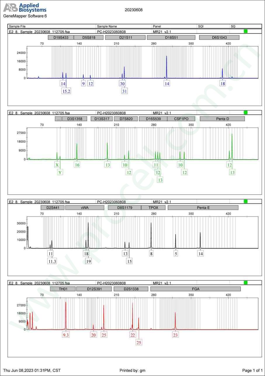 NTERA-2 (人恶性多发性畸胎瘤细胞) (STR鉴定正确