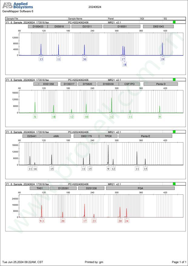 NCI-H2030 (人非小细胞肺癌细胞) (STR鉴定正确