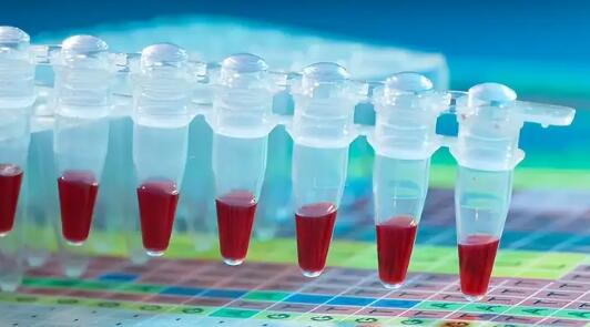 PCR检测试剂盒反应要素与条件解读