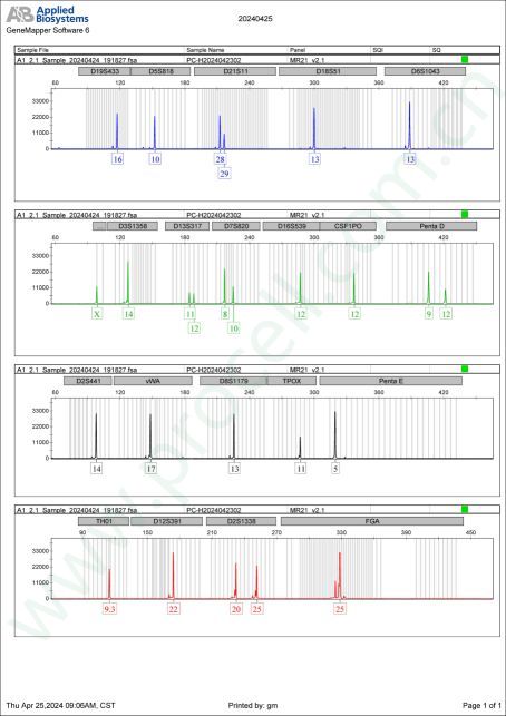 NCI-H2444 (人非小细胞肺癌细胞) (STR鉴定正确
