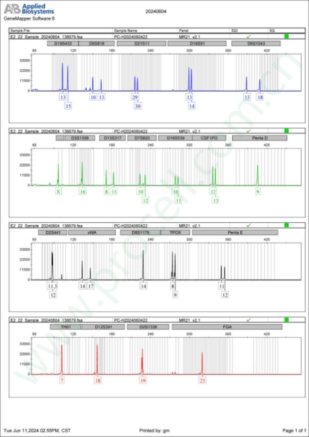 SKNO-1 (人急性髓系白血病细胞) (STR鉴定正确)