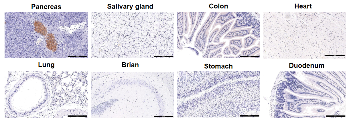 一文认识王牌药靶家族GPCR