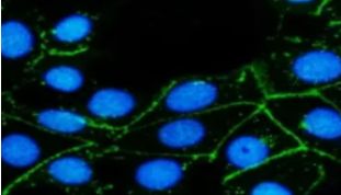 实验技术学习指南 | 免疫组织化学染色实验存在问题的原因分析与解决方案