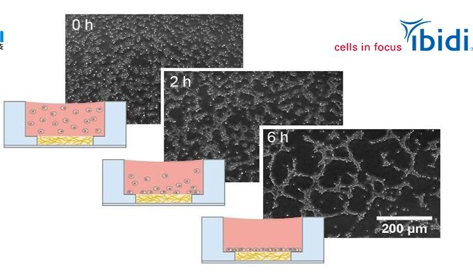 血管生成实验必备指南|优化实验方案和关键参数
