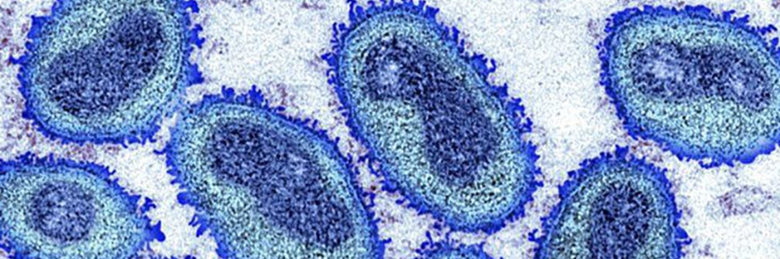 RD重组Monkeypox Virus A35R His-t