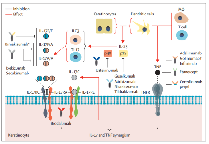 造模百科 | 银屑病小鼠模型