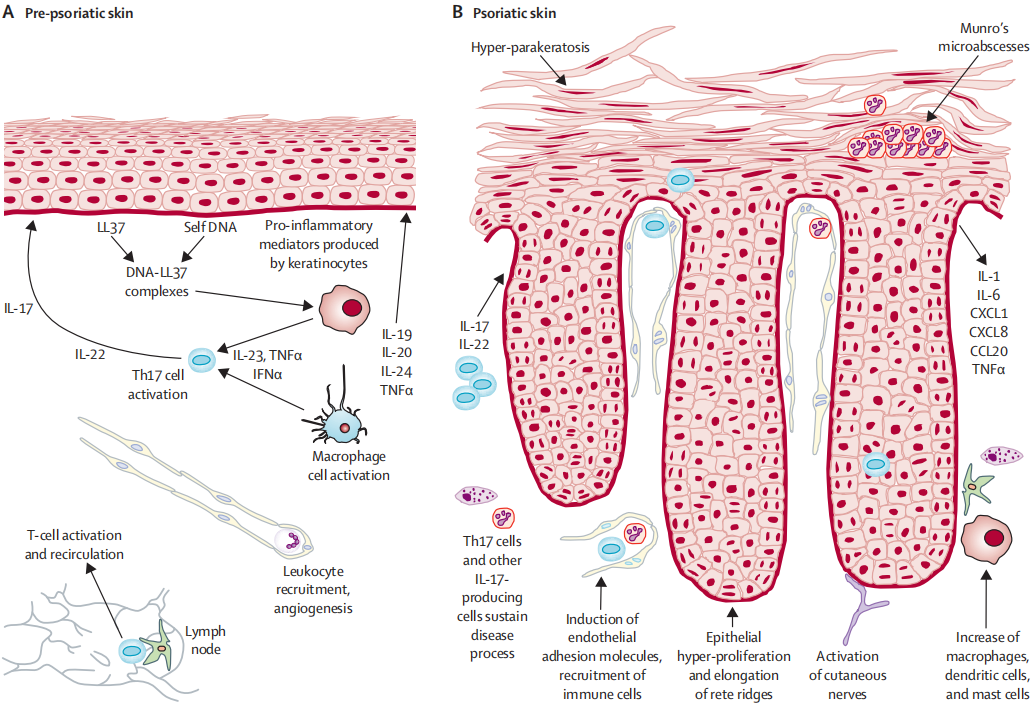 造模百科 | 银屑病小鼠模型