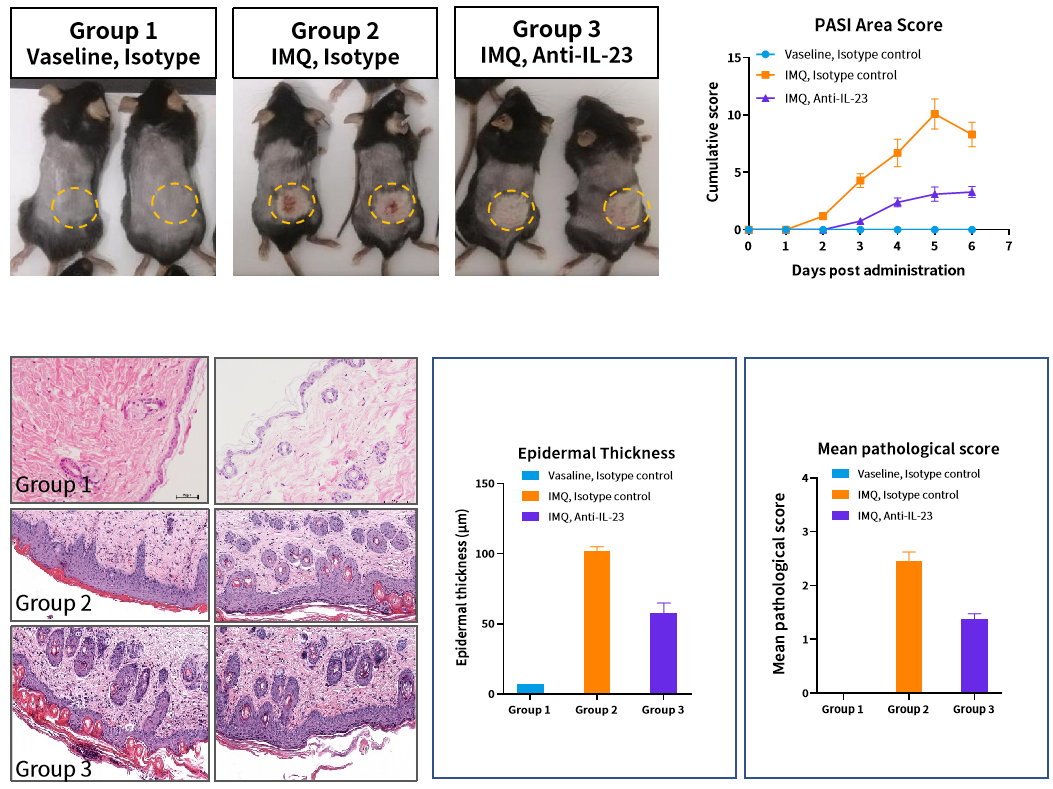 造模百科 | 银屑病小鼠模型