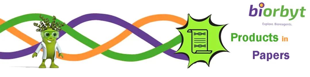 【Biorbyt文献】Kmt2c或Kmt2d的缺失会驱动脑转移瘤的发生