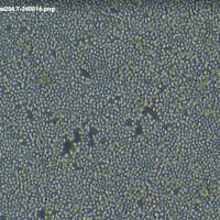 CHL-1/LUC(带荧光素酶)