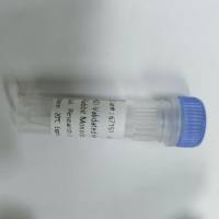 KD-Validated Anti-Cyclin A2 Rabbit Monoclonal Antibody