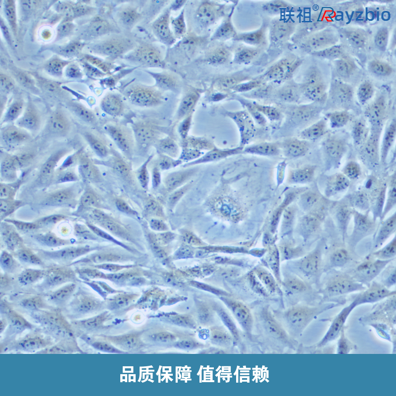 深入探讨多细胞生物体内细胞凋亡的精密调控机制