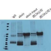 RNA免疫共沉淀(RIP)试剂盒