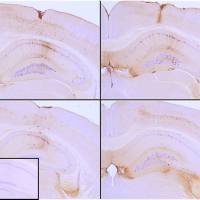 Alpha Synuclein 单体: 生物素标记的(羧基末端)