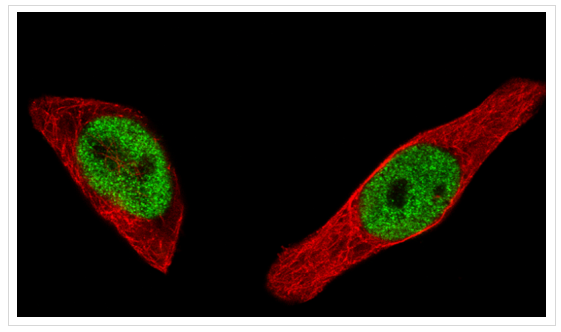 Atlas antibodies抗ESR1抗体暑假放价