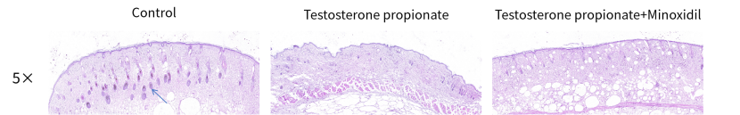 造模百科 | 雄激素性脱发小鼠模型