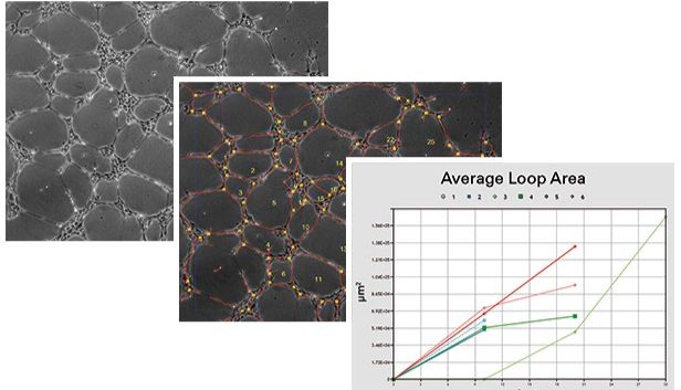 血管生成实验数据怎么分析，这些秘诀您都知道么？