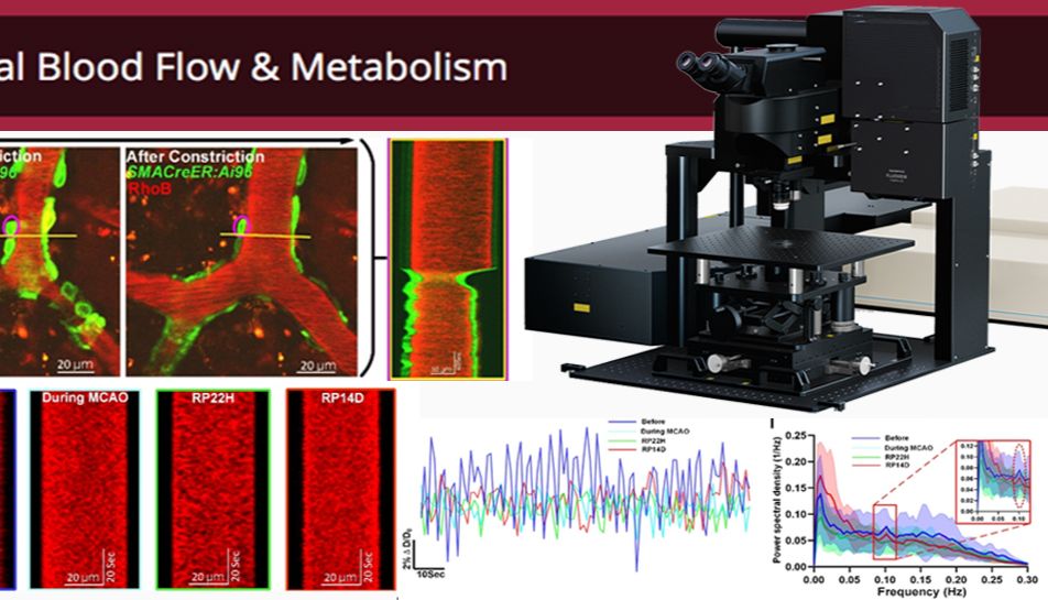 EVIDENT助力西湖大学贾洁敏团队开发高时空分辨率血管动力学分析算法