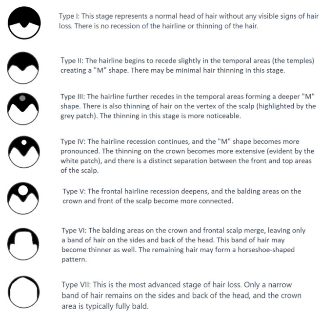 造模百科 | 雄激素性脱发小鼠模型