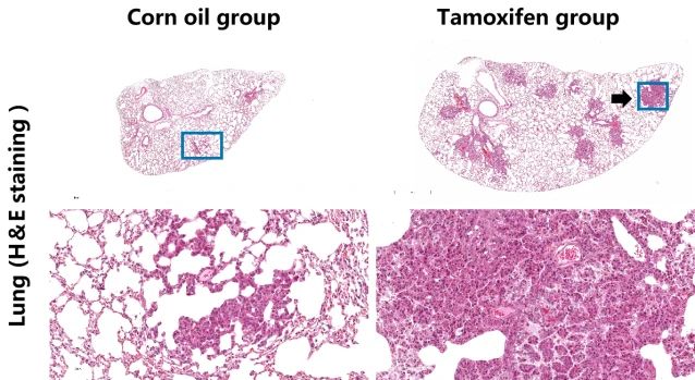 癌症研究新纪元：探索原位肿瘤模型的全貌