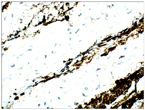 FabGennix-PDE6-β抗体促销中