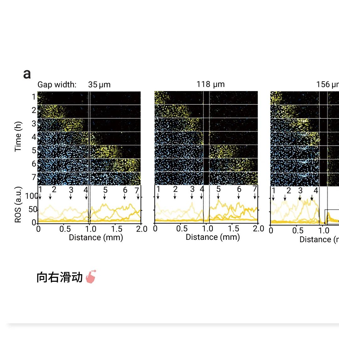 前沿热点 | 物理模型助攻，铁死亡再登 Nature！ |MedChemExpress