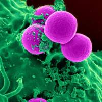 外泌体整体技术服务