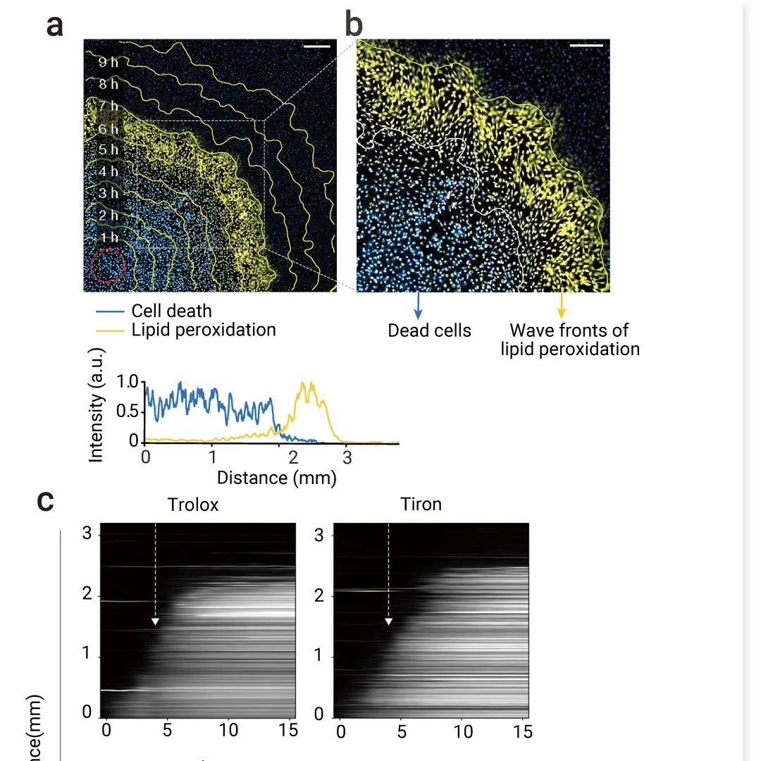 前沿热点 | 物理模型助攻，铁死亡再登 Nature！ |MedChemExpress