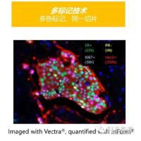 多色标记免疫荧光-多重组织成像技术
