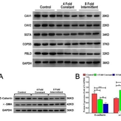 Western Blot(蛋白质免疫印迹)